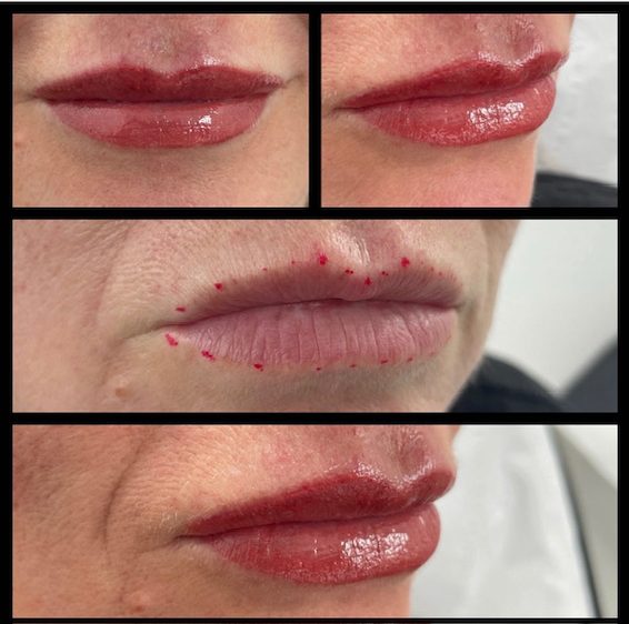 tmf-training-studio-lip-blush-before-and-after