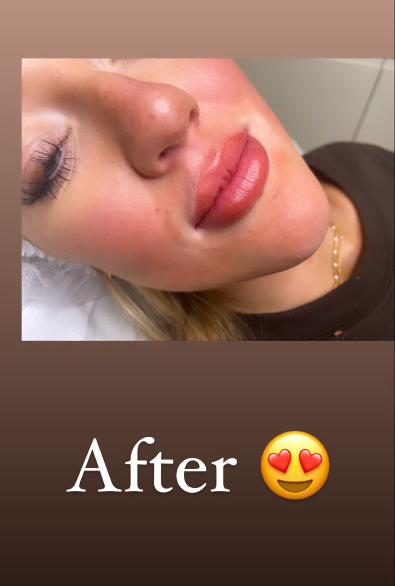 tmf-training-studio-lips-x-after