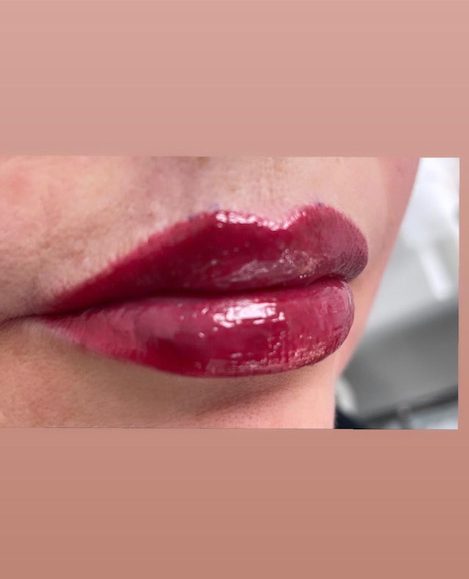 tmf-training-studio-lips-y-after