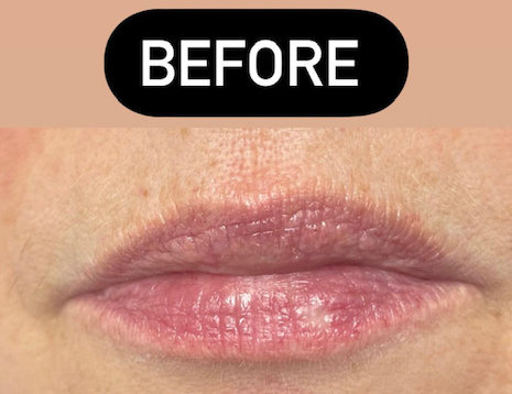 TMF Training Studio SPMU Lips