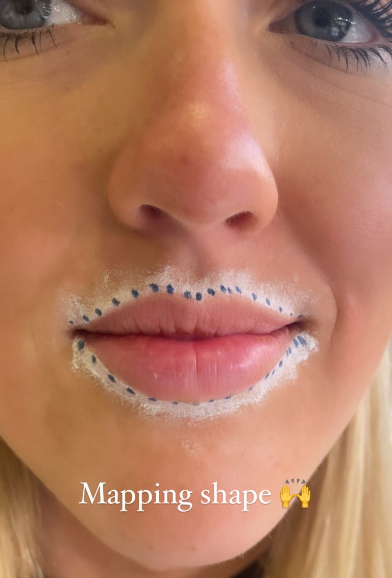 TMF Training Studio SPMU Lips